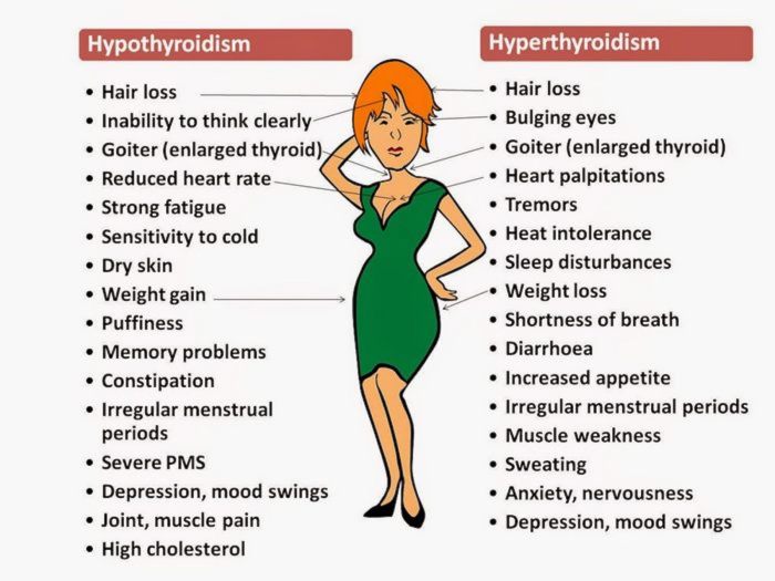 Hypothyroidism treatable complications genetic iatrogenic