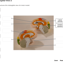 Brain human anatomy labeled midsagittal system diagram labelled cut sheep structures limbic dissection sagital parts labels nervous thalamus choose board