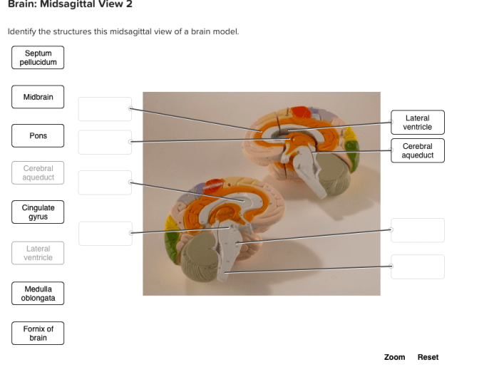 Brain human anatomy labeled midsagittal system diagram labelled cut sheep structures limbic dissection sagital parts labels nervous thalamus choose board